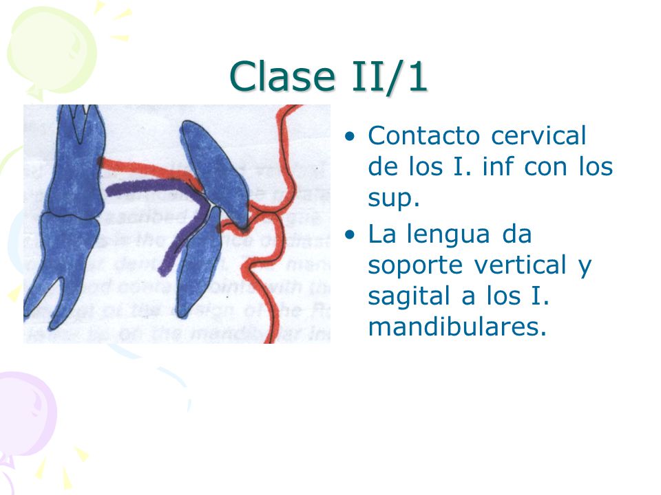 Clase II/1 Contacto cervical de los I. inf con los sup.