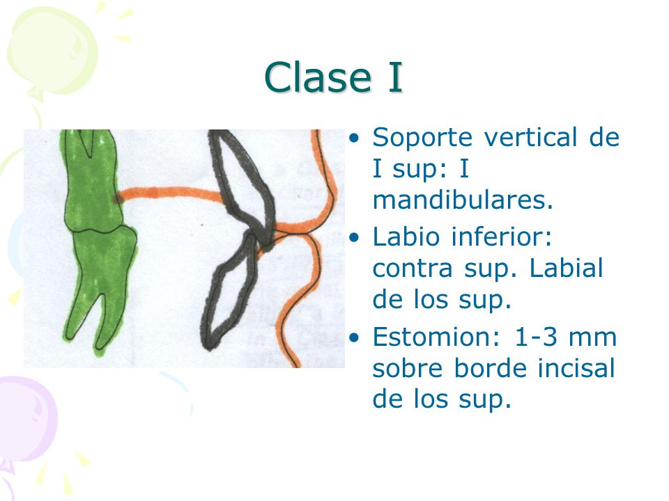 Clase I Soporte vertical de I sup: I mandibulares.