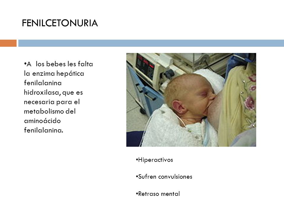FENILCETONURIA A los bebes les falta la enzima hepática fenilalanina hidroxilasa, que es necesaria para el metabolismo del aminoácido fenilalanina.