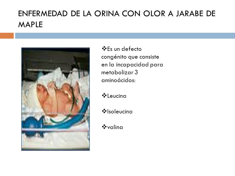 ENFERMEDAD DE LA ORINA CON OLOR A JARABE DE MAPLE