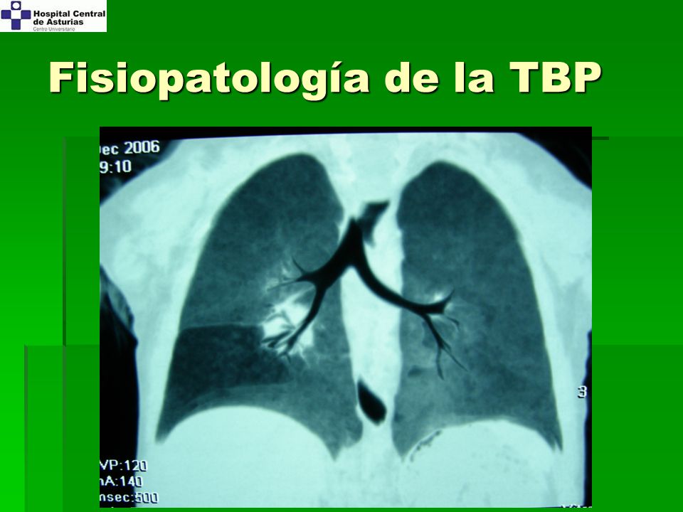 Fisiopatología de la TBP
