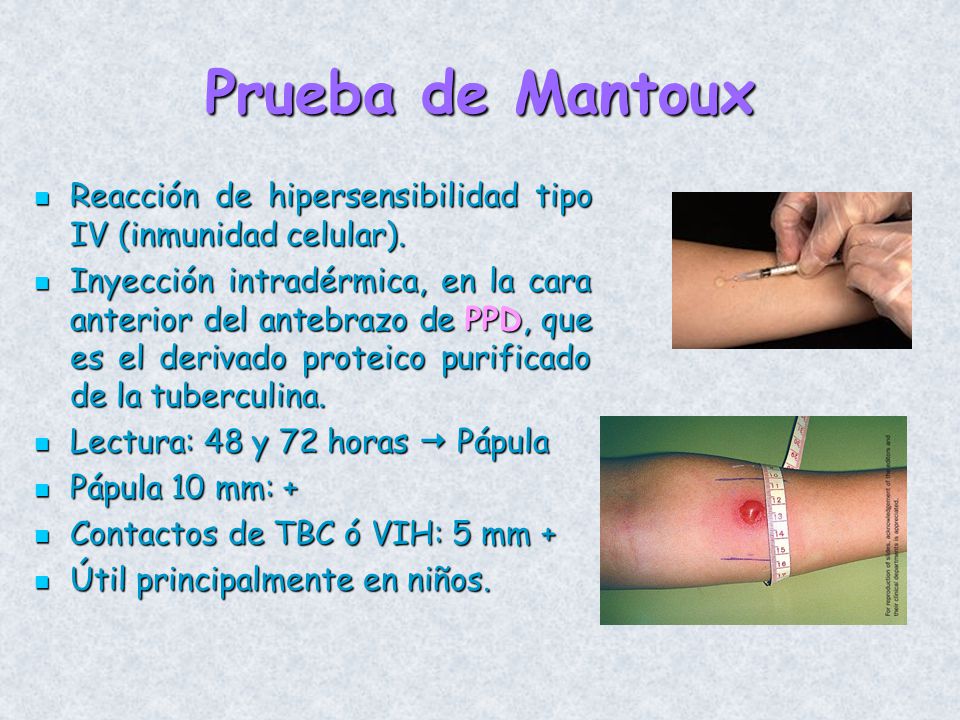 Prueba de Mantoux Reacción de hipersensibilidad tipo IV (inmunidad celular).
