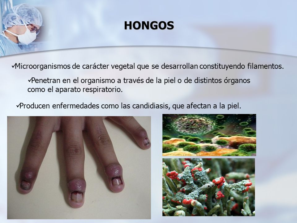 HONGOS Microorganismos de carácter vegetal que se desarrollan constituyendo filamentos.