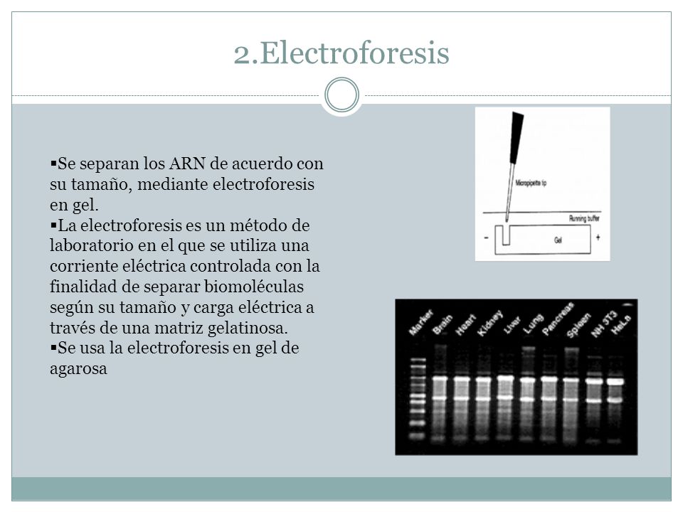 2.Electroforesis Se separan los ARN de acuerdo con su tamaño, mediante electroforesis en gel.
