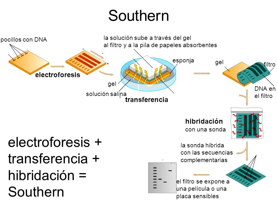 Southern electroforesis + transferencia + hibridación = electroforesis