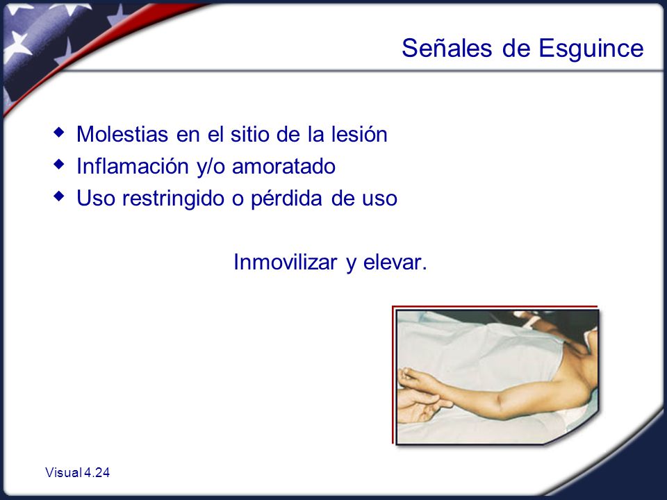 Señales de Esguince Molestias en el sitio de la lesión