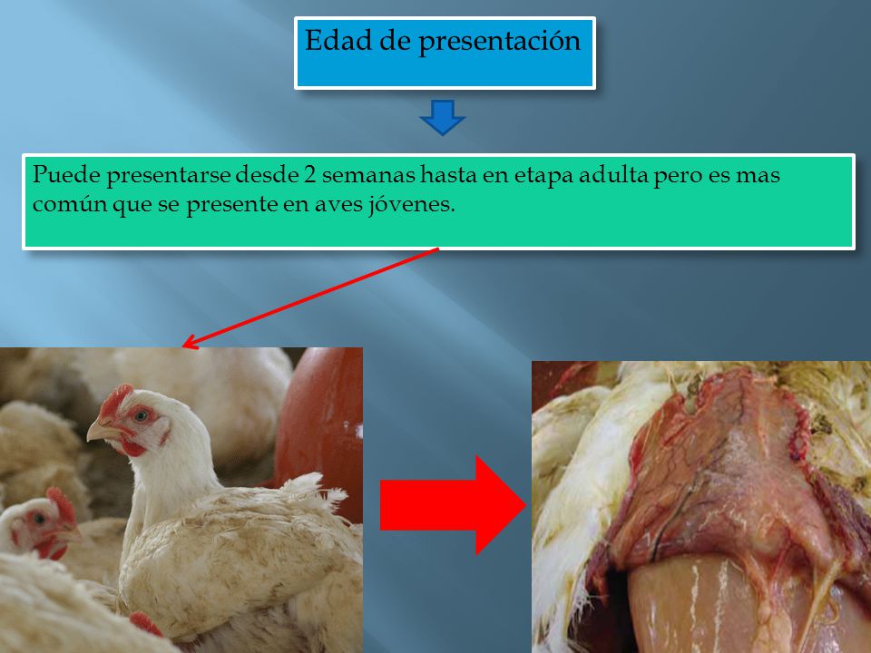 Edad de presentación Puede presentarse desde 2 semanas hasta en etapa adulta pero es mas común que se presente en aves jóvenes.