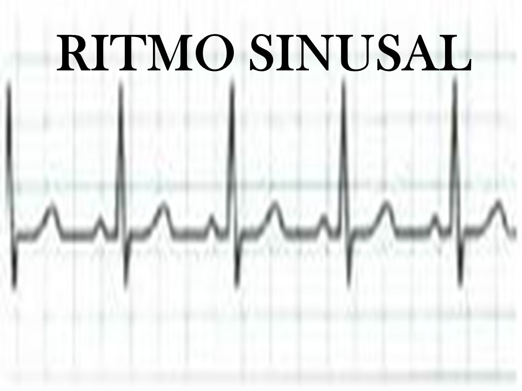 RITMO SINUSAL 12