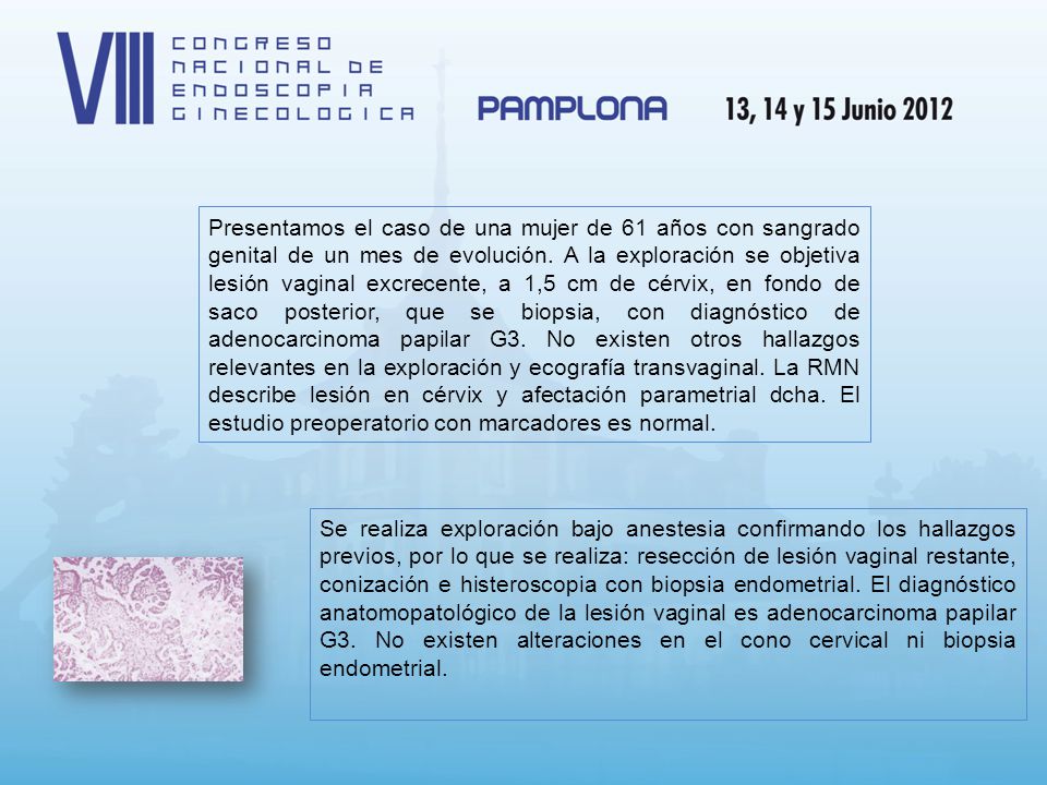Presentamos el caso de una mujer de 61 años con sangrado genital de un mes de evolución. A la exploración se objetiva lesión vaginal excrecente, a 1,5 cm de cérvix, en fondo de saco posterior, que se biopsia, con diagnóstico de adenocarcinoma papilar G3. No existen otros hallazgos relevantes en la exploración y ecografía transvaginal. La RMN describe lesión en cérvix y afectación parametrial dcha. El estudio preoperatorio con marcadores es normal.