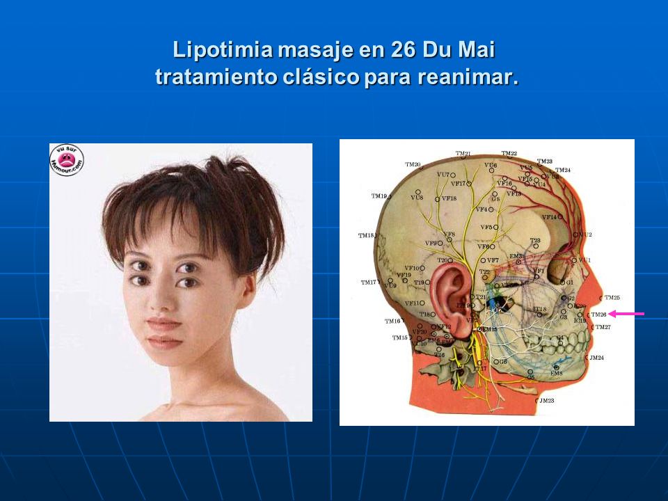 Lipotimia masaje en 26 Du Mai tratamiento clásico para reanimar.
