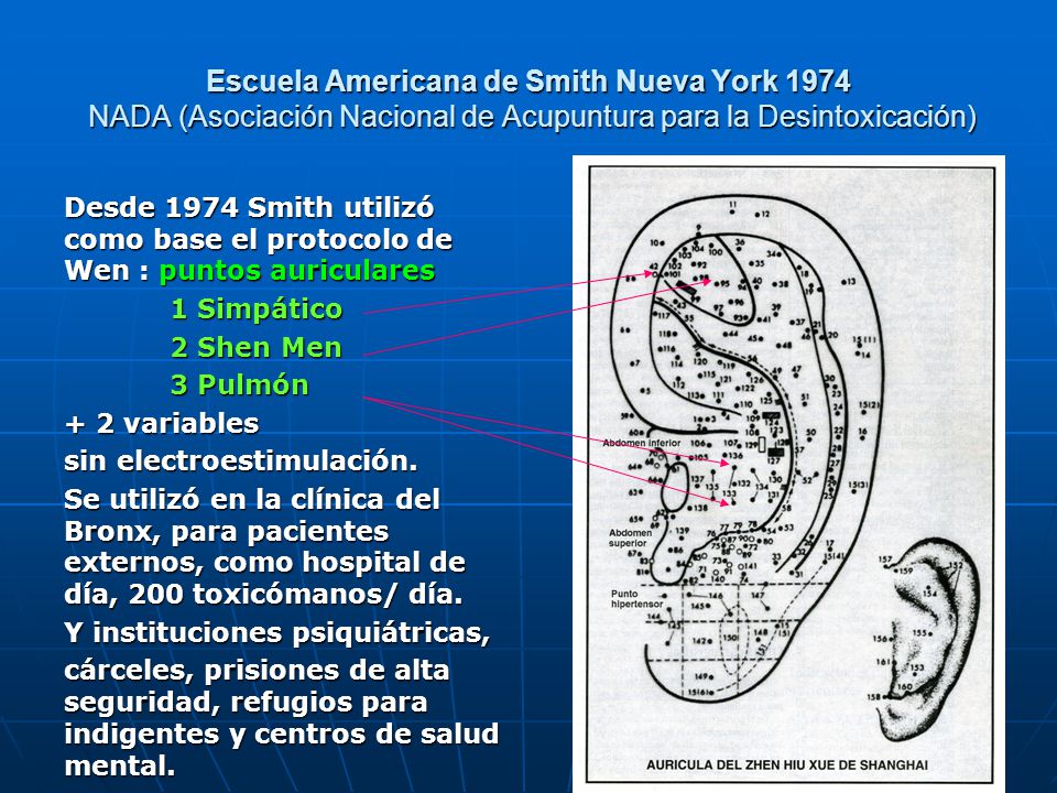Escuela Americana de Smith Nueva York 1974 NADA (Asociación Nacional de Acupuntura para la Desintoxicación)