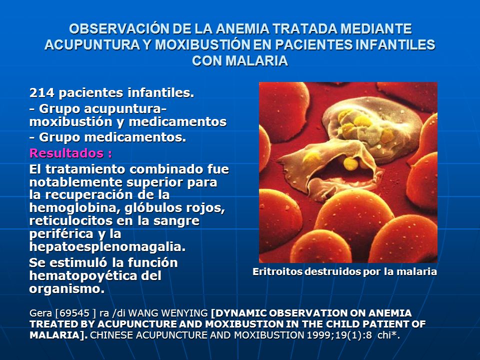 OBSERVACIÓN DE LA ANEMIA TRATADA MEDIANTE ACUPUNTURA Y MOXIBUSTIÓN EN PACIENTES INFANTILES CON MALARIA