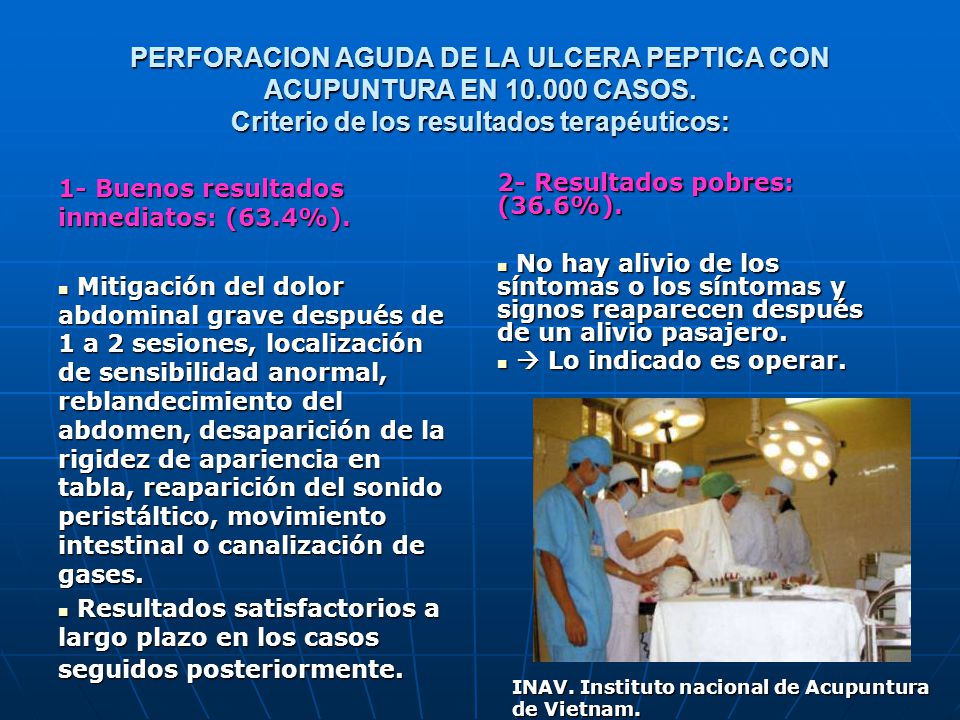 PERFORACION AGUDA DE LA ULCERA PEPTICA CON ACUPUNTURA EN CASOS