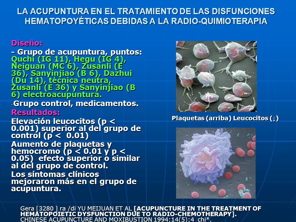 LA ACUPUNTURA EN EL TRATAMIENTO DE LAS DISFUNCIONES HEMATOPOYÉTICAS DEBIDAS A LA RADIO-QUIMIOTERAPIA