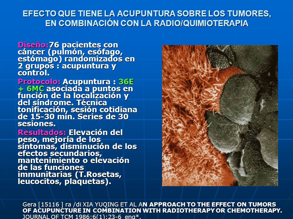 EFECTO QUE TIENE LA ACUPUNTURA SOBRE LOS TUMORES, EN COMBINACIÓN CON LA RADIO/QUIMIOTERAPIA