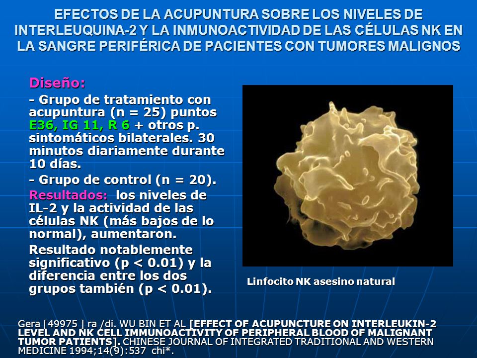 EFECTOS DE LA ACUPUNTURA SOBRE LOS NIVELES DE INTERLEUQUINA-2 Y LA INMUNOACTIVIDAD DE LAS CÉLULAS NK EN LA SANGRE PERIFÉRICA DE PACIENTES CON TUMORES MALIGNOS