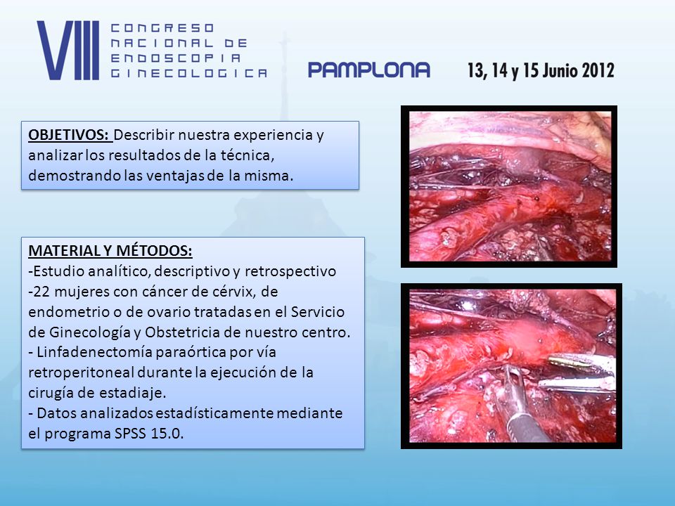 OBJETIVOS: Describir nuestra experiencia y analizar los resultados de la técnica, demostrando las ventajas de la misma.