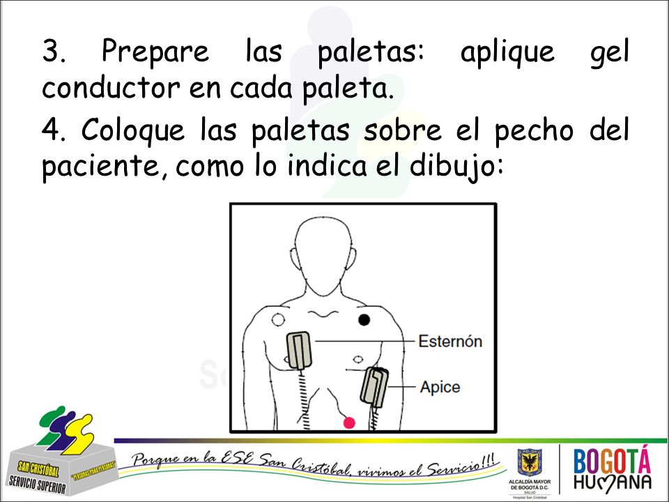 3. Prepare las paletas: aplique gel conductor en cada paleta. 4