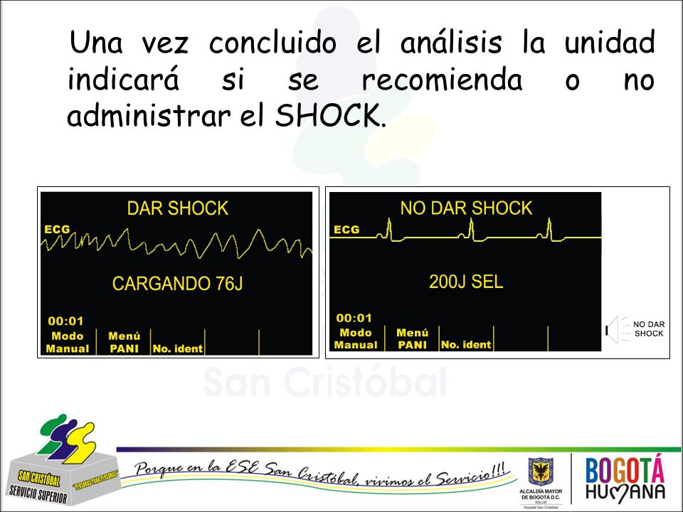 Una vez concluido el análisis la unidad indicará si se recomienda o no administrar el SHOCK.