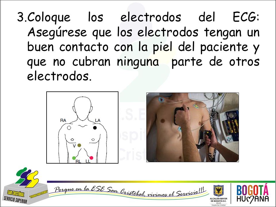 3.Coloque los electrodos del ECG: Asegúrese que los electrodos tengan un buen contacto con la piel del paciente y que no cubran ninguna parte de otros electrodos.
