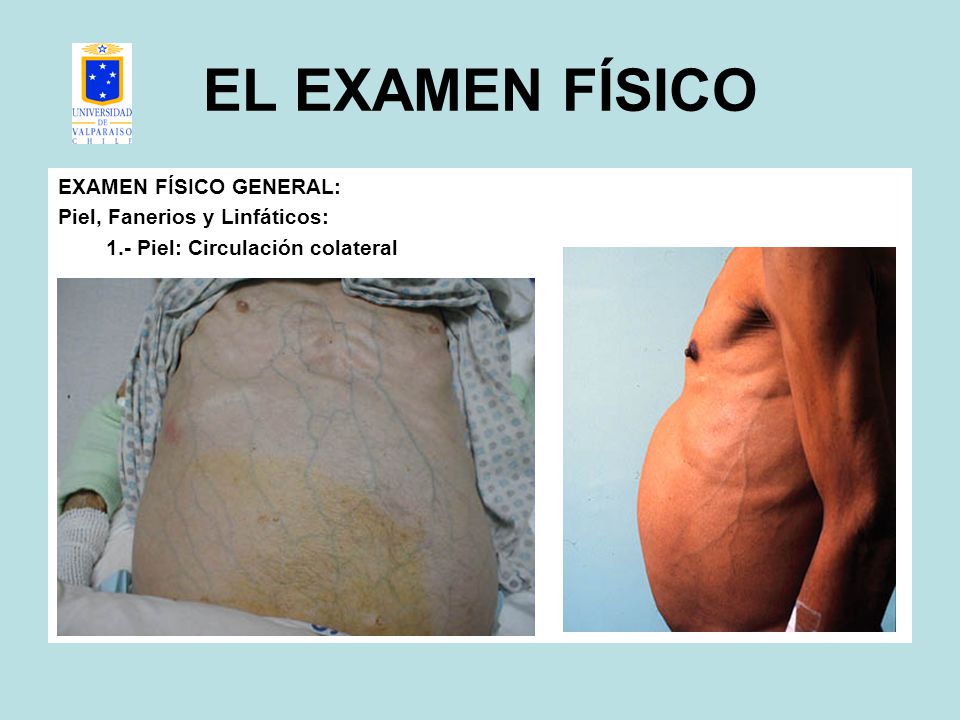 EL EXAMEN FÍSICO EXAMEN FÍSICO GENERAL: Piel, Fanerios y Linfáticos: