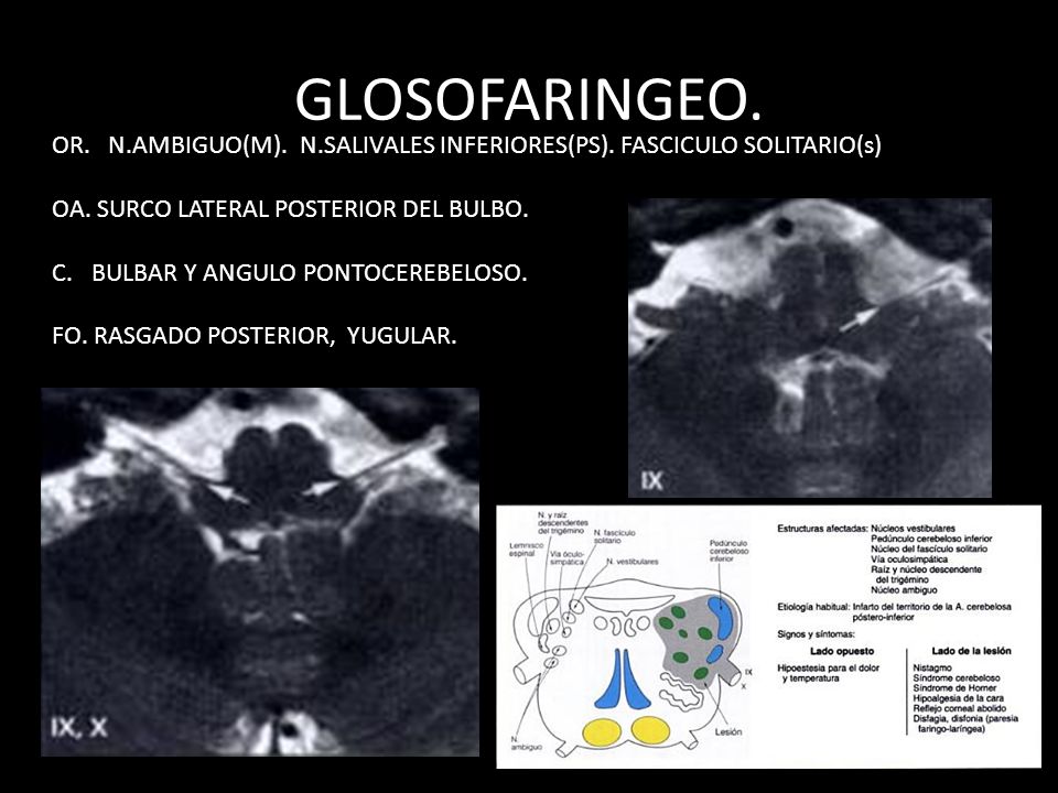 GLOSOFARINGEO. OR. N.AMBIGUO(M). N.SALIVALES INFERIORES(PS). FASCICULO SOLITARIO(s) OA. SURCO LATERAL POSTERIOR DEL BULBO.