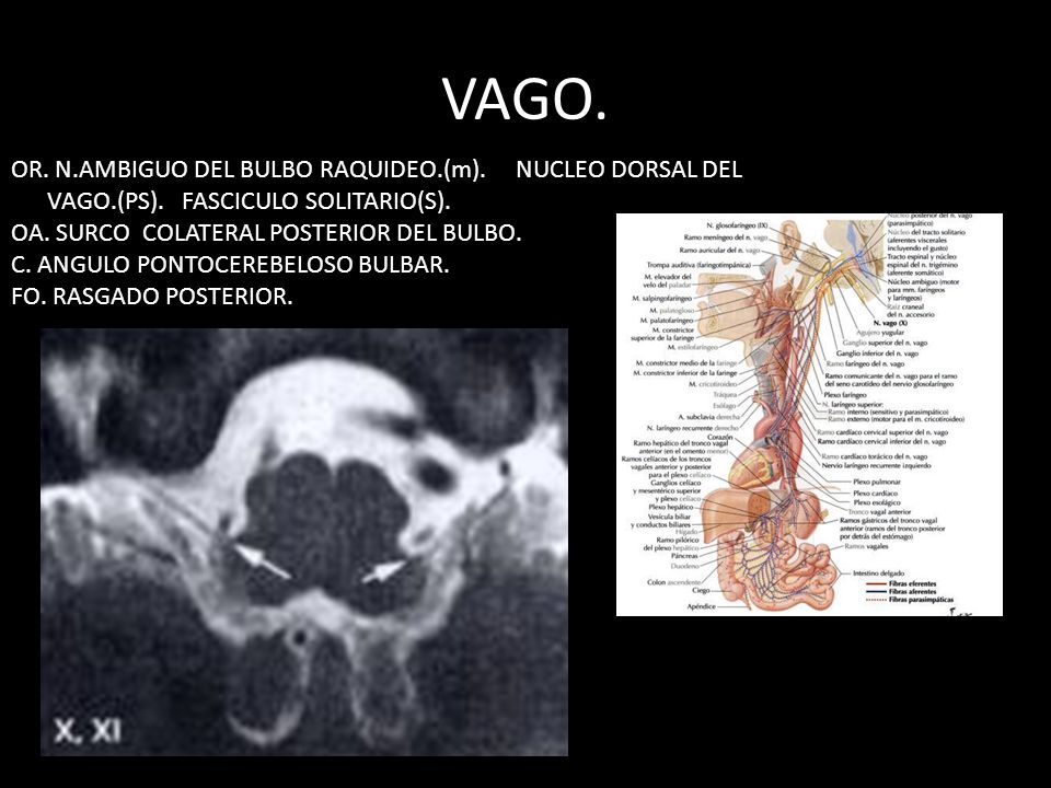 VAGO. OR. N.AMBIGUO DEL BULBO RAQUIDEO.(m). NUCLEO DORSAL DEL