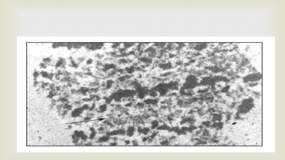Estos cromosomas estan presentes en la interfase, pero estas celulas no entran de nuevo a la mitosis.