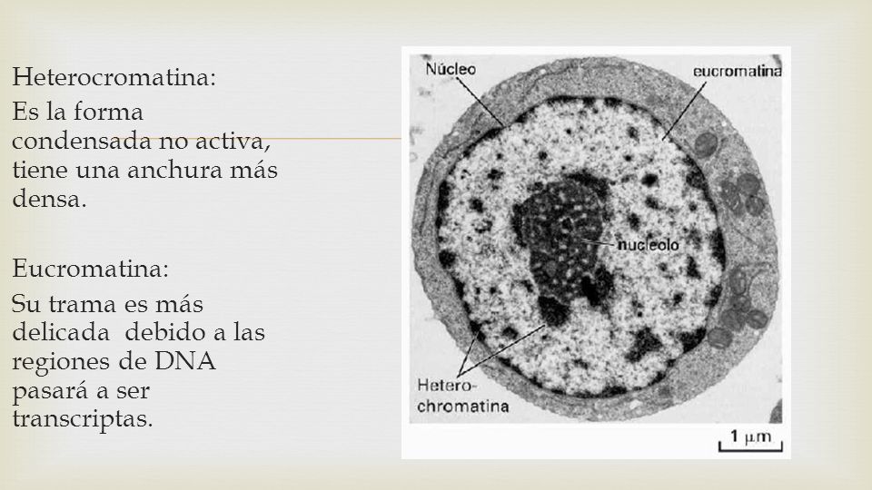 Heterocromatina: Es la forma condensada no activa, tiene una anchura más densa. Eucromatina: Su trama es más delicada debido a las regiones de DNA pasará a ser transcriptas.
