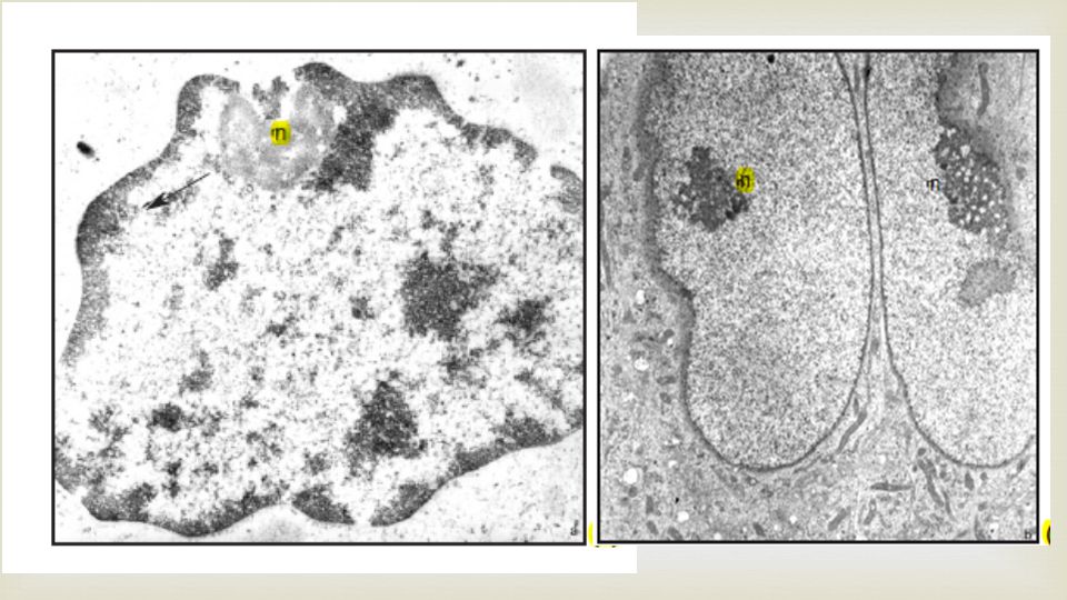 Se pueden visualizar cúmulos de cromatina de diferente tamaño y composición , dependiendo del estado de compactación de material cromosómico en los diferentes eucariontes y dentro de cada uno de ellos dicha compactación varia en las diferentes estirpes celulares y estados cito fisiológicos .