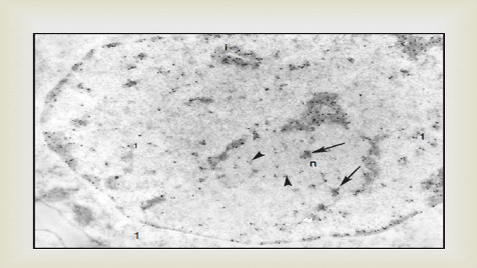 El nucléolo esta parcialmente rodeada por cromatina compacta y contiene en su interior algunos pequeños cúmulos de cromatina compacta (flechas) y cromatina laxa marcada con oro (cabeza de flecha) .algunos filamentos de cromatina laxa situados en el nucleoplasma están también marcado con oro .delgadas invaginaciones de la envoltura nuclear están rodeadas por cromatina compacta .