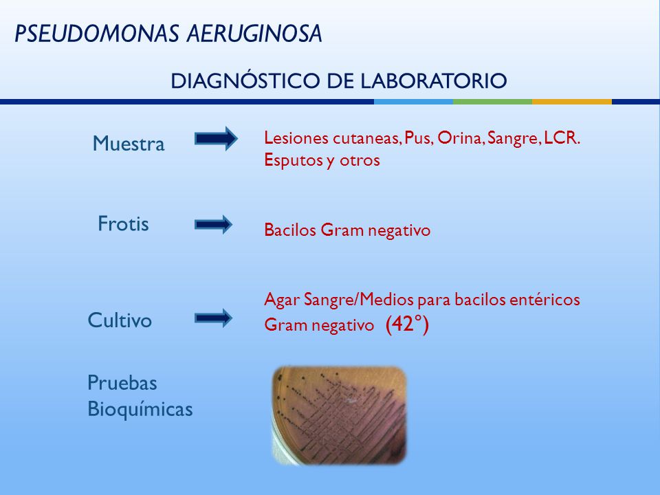 PSEUDOMONAS AERUGINOSA