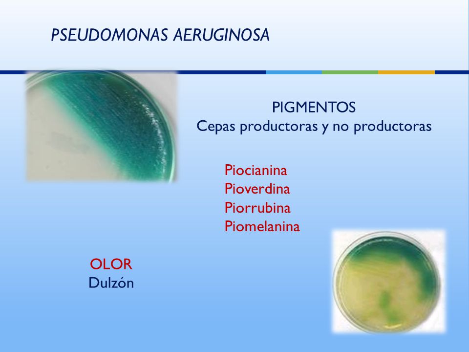 Cepas productoras y no productoras