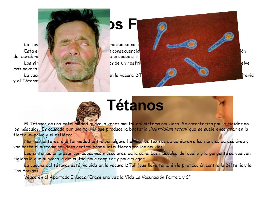 Tos Ferina La Tos Ferina es una infección respiratoria que se caracteriza por la tos peculiar que presenta.