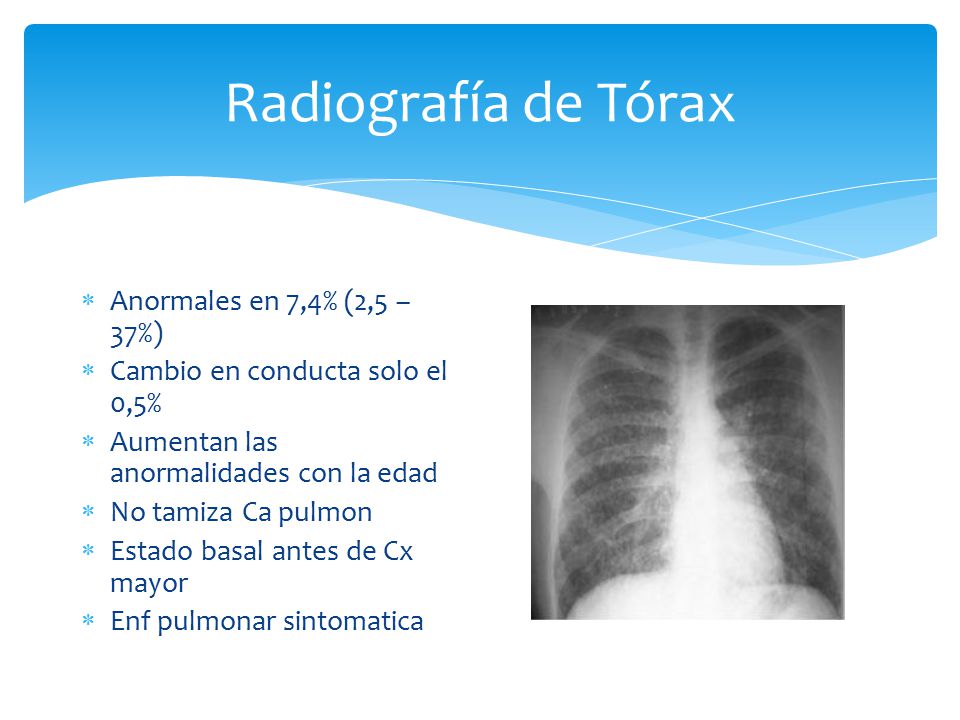 Radiografía de Tórax Anormales en 7,4% (2,5 – 37%)