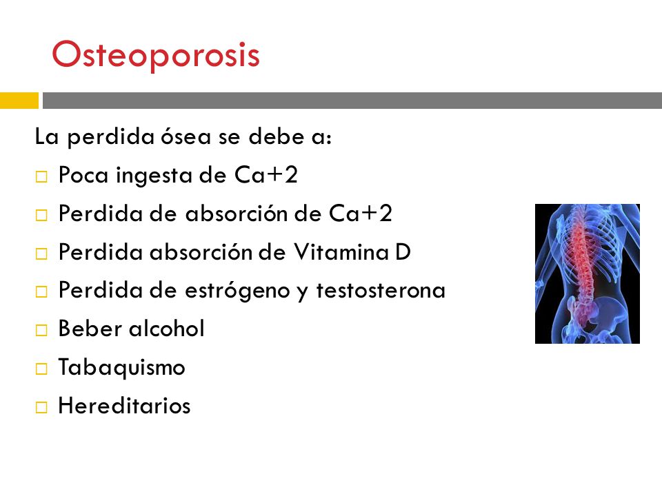 Osteoporosis La perdida ósea se debe a: Poca ingesta de Ca+2