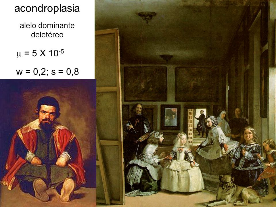 acondroplasia = 5 X 10-5 w = 0,2; s = 0,8 alelo dominante deletéreo