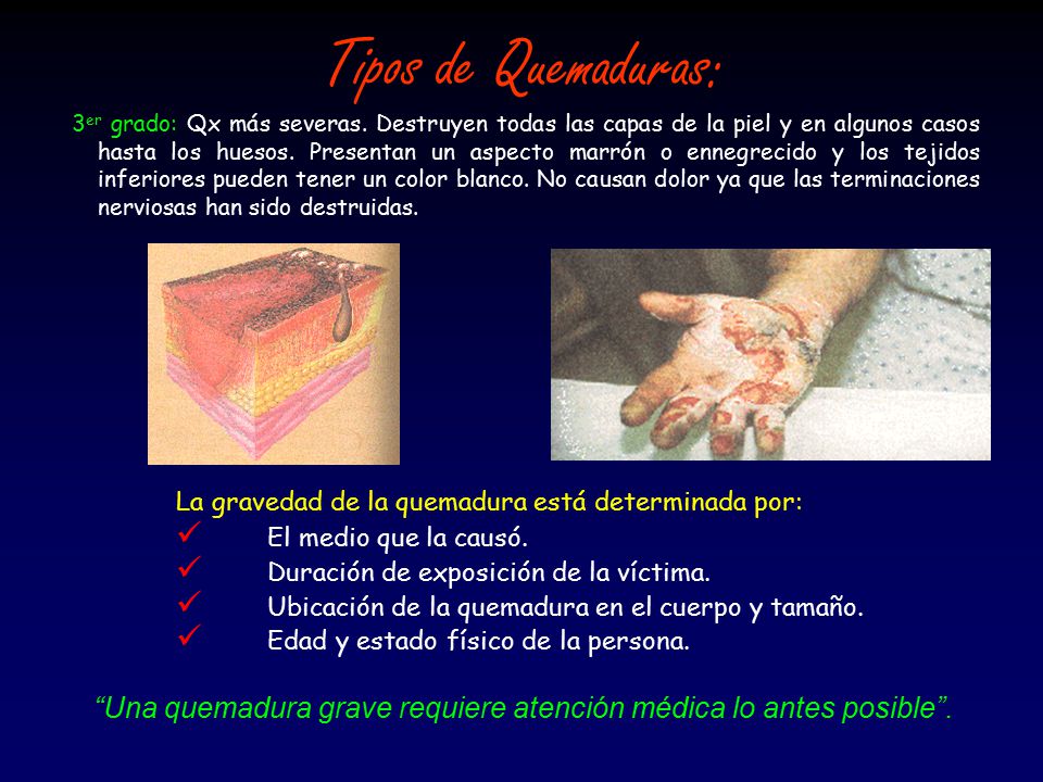 Una quemadura grave requiere atención médica lo antes posible .