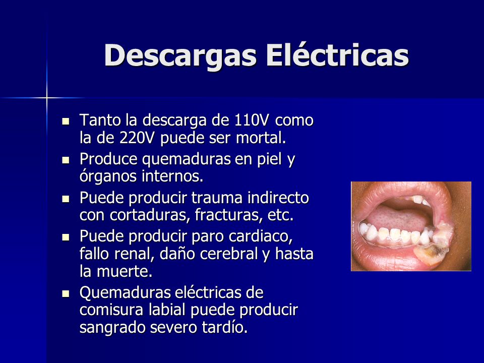Descargas Eléctricas Tanto la descarga de 110V como la de 220V puede ser mortal. Produce quemaduras en piel y órganos internos.