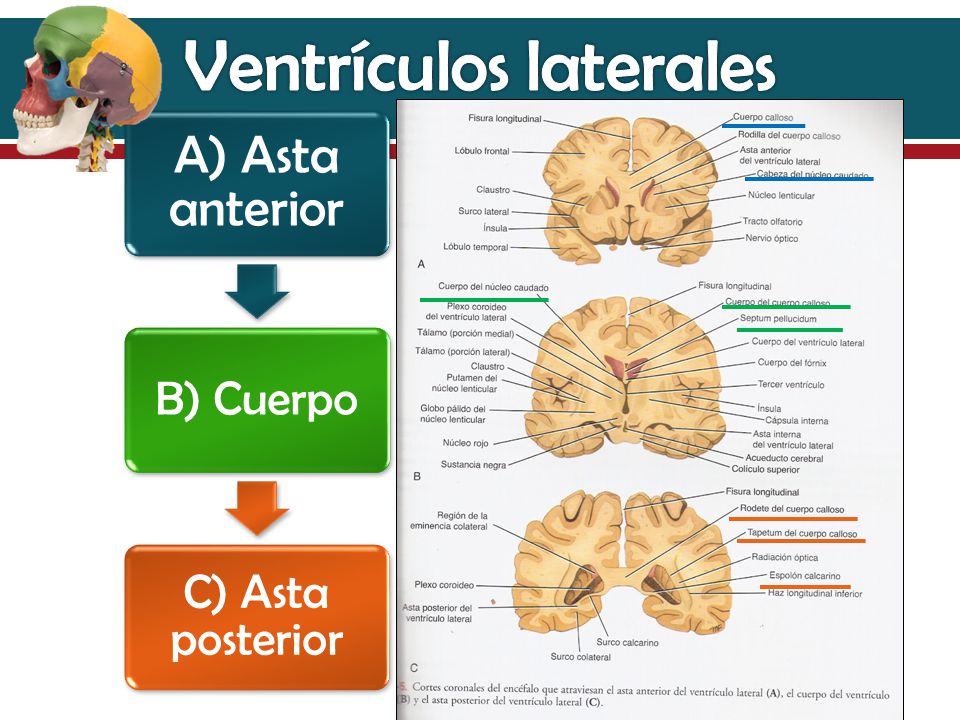 Ventrículos laterales