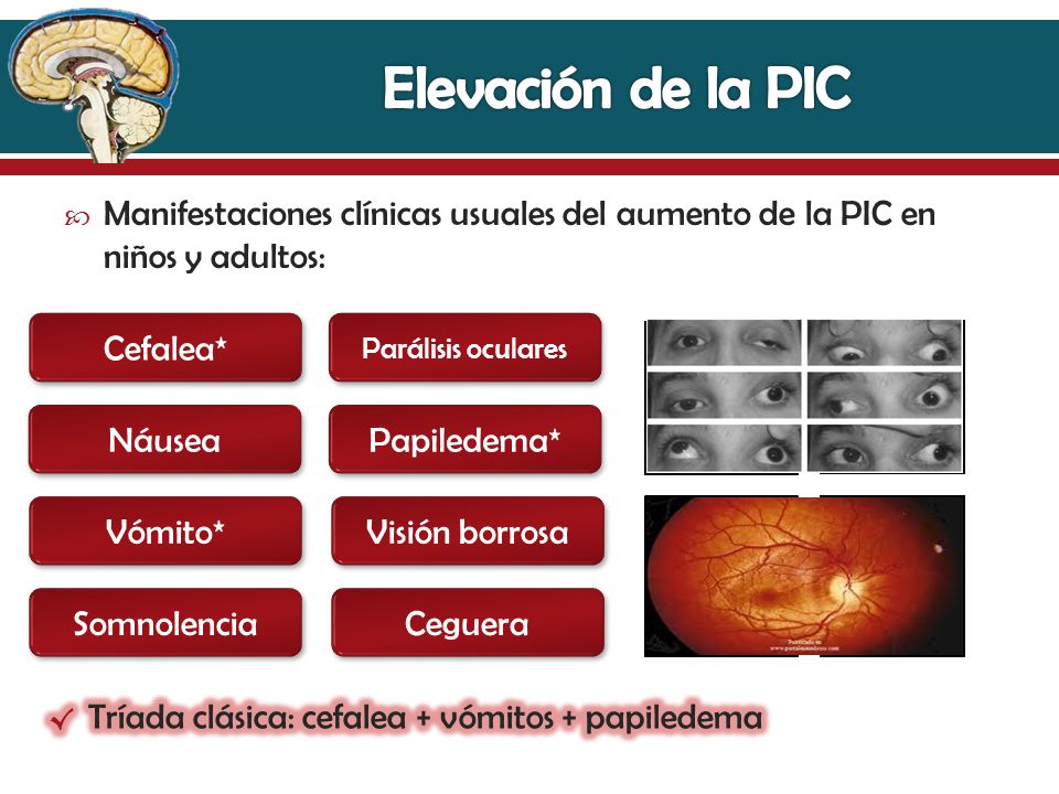 Elevación de la PIC Manifestaciones clínicas usuales del aumento de la PIC en niños y adultos: Cefalea*
