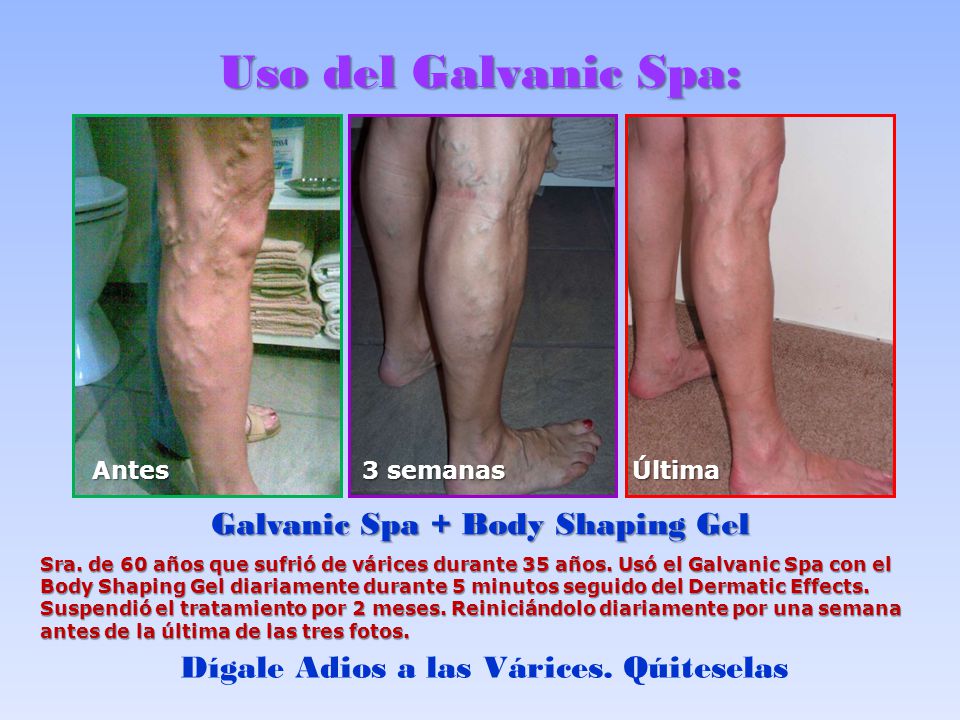 Galvanic Spa + Body Shaping Gel Dígale Adios a las Várices. Qúiteselas