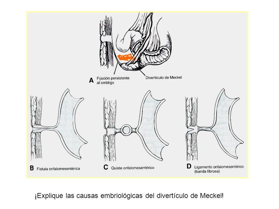 El conducto onfalomesentérico se encuentra conectado con el intestino medio