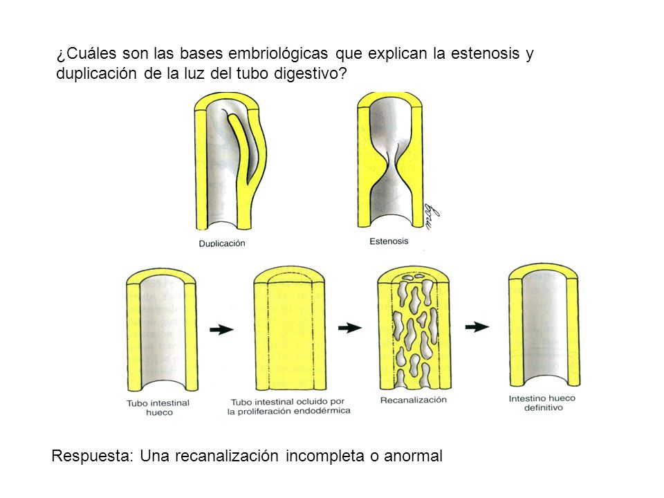 ¿Cuáles son las bases embriológicas que explican la estenosis y duplicación de la luz del tubo digestivo
