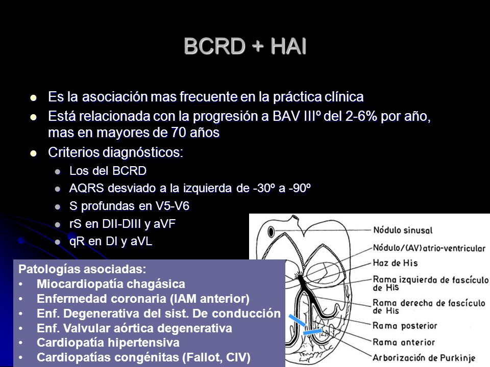 BCRD + HAI Es la asociación mas frecuente en la práctica clínica