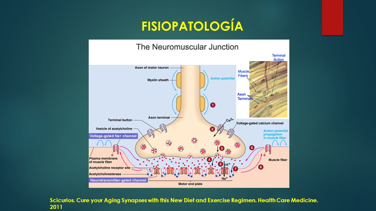 FISIOPATOLOGÍA Scicurios. Cure your Aging Synapses with this New Diet and Exercise Regimen.