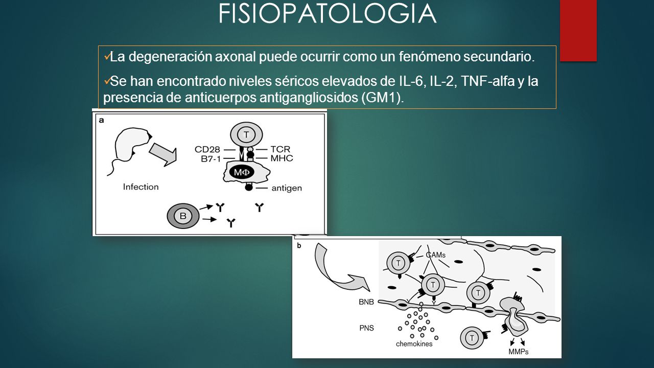FISIOPATOLOGIA La degeneración axonal puede ocurrir como un fenómeno secundario.