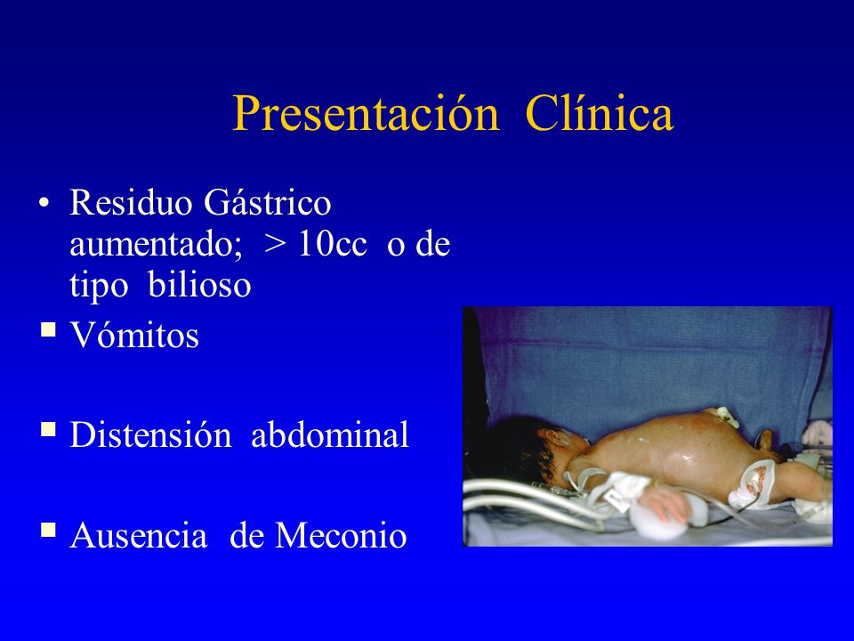 Presentación Clínica Residuo Gástrico aumentado; > 10cc o de tipo bilioso. Vómitos. Distensión abdominal.