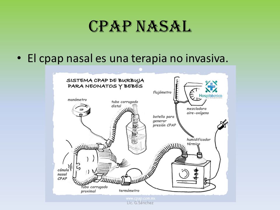 CPAP NASAL El cpap nasal es una terapia no invasiva. Lic. G.Sánchez