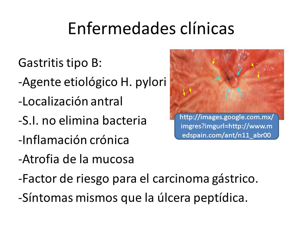Enfermedades clínicas